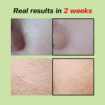 Sungboon Editor Green Tomato Pore Lifting Ampoule*