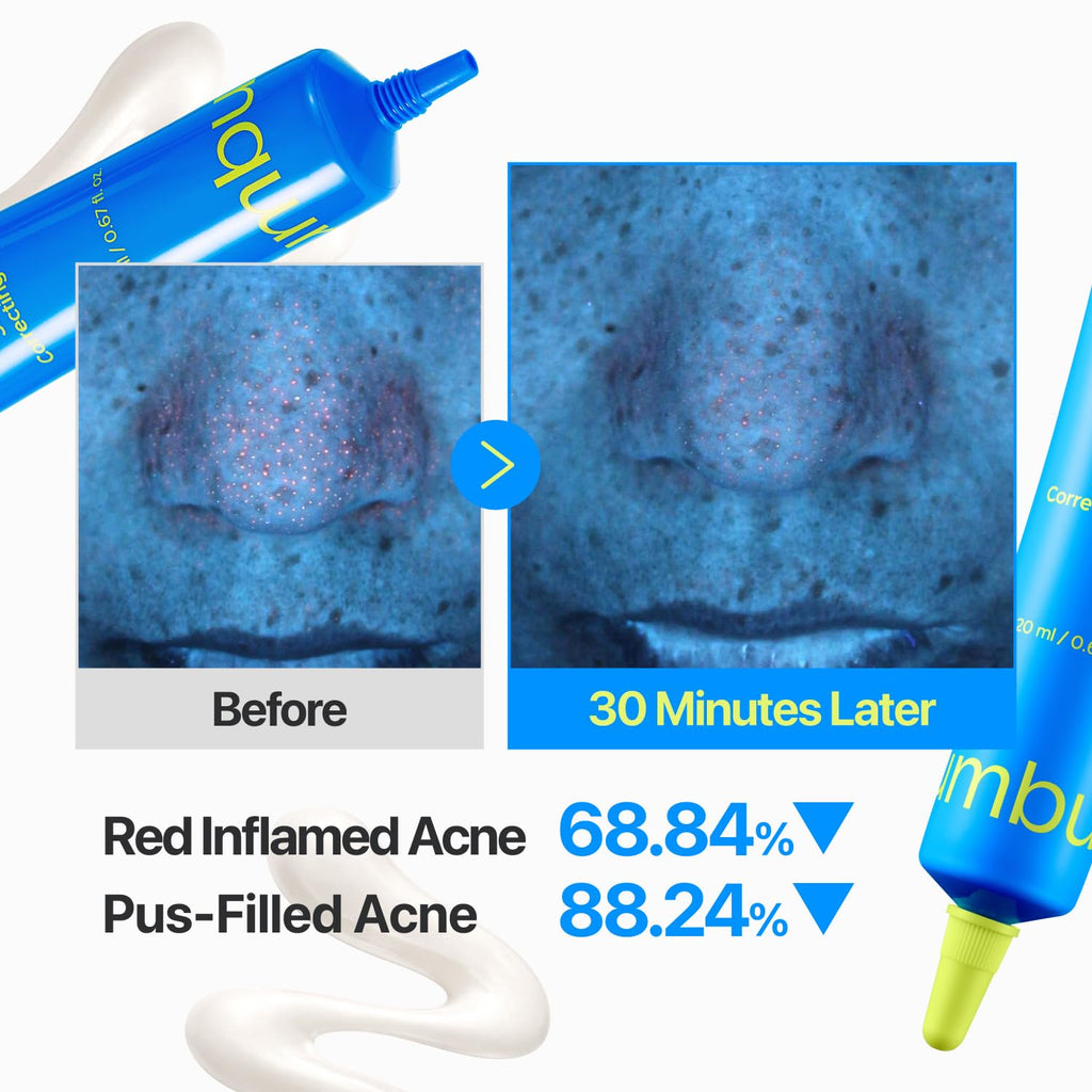 numbuzin Zero Blemish 3X Spot Correcting Cream for Sensitive Skin