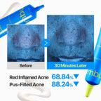numbuzin Zero Blemish 3X Spot Correcting Cream for Sensitive Skin