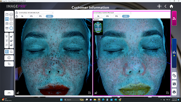 Skin Analysis Session (In Person)