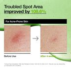 Anua Azelaic Acid Serum