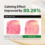 dewdap Cicatea Calming Repair Ampoule