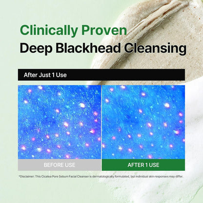 dewdap Cicatea Pore & Sebum Pack Cleanser (150 ml)