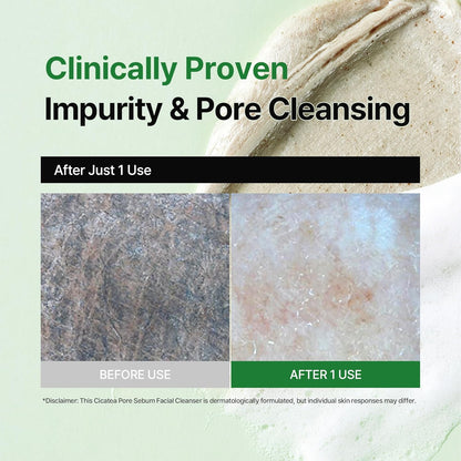 dewdap Cicatea Pore & Sebum Pack Cleanser (150 ml)