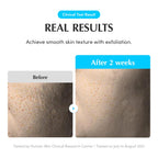 EQQUALBERRY Swimming Pool Toner