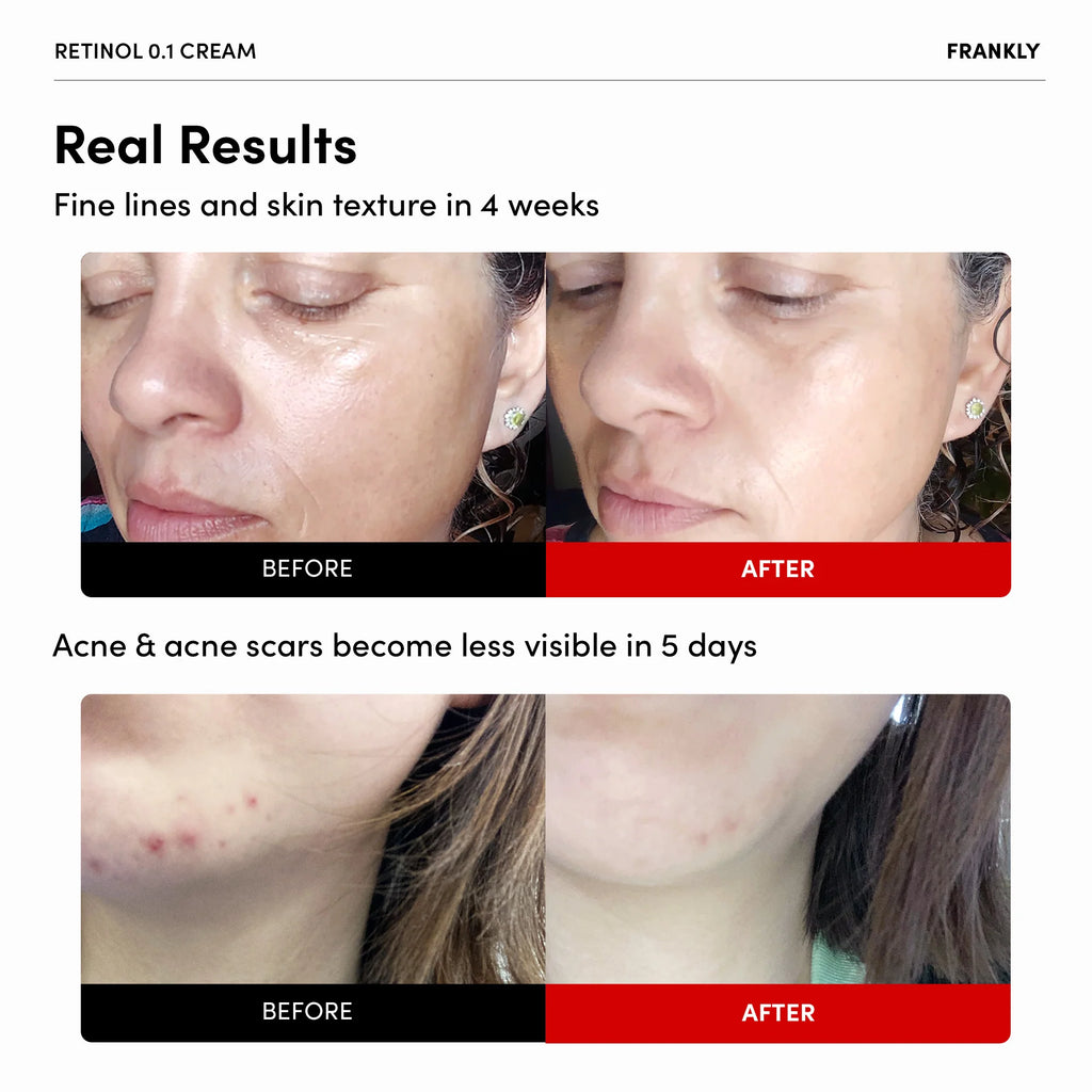 FRANKLY Retinol 0.1% Cream 30 mL
