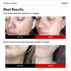 FRANKLY Retinol 0.1% Cream 30 mL