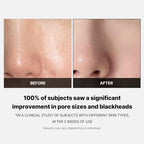 Medicube Zero Pore Pad 2.0 (2)