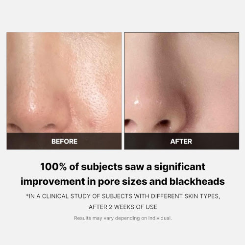 Medicube Zero Pore Pad 2.0 (2)